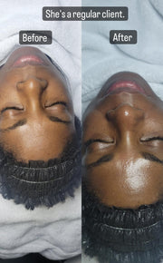 Signature Facial Treatment